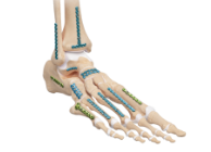 Arthrex - Compression FT Screw, 2.5 Micro, 40 mm Length - AR-8725-40H